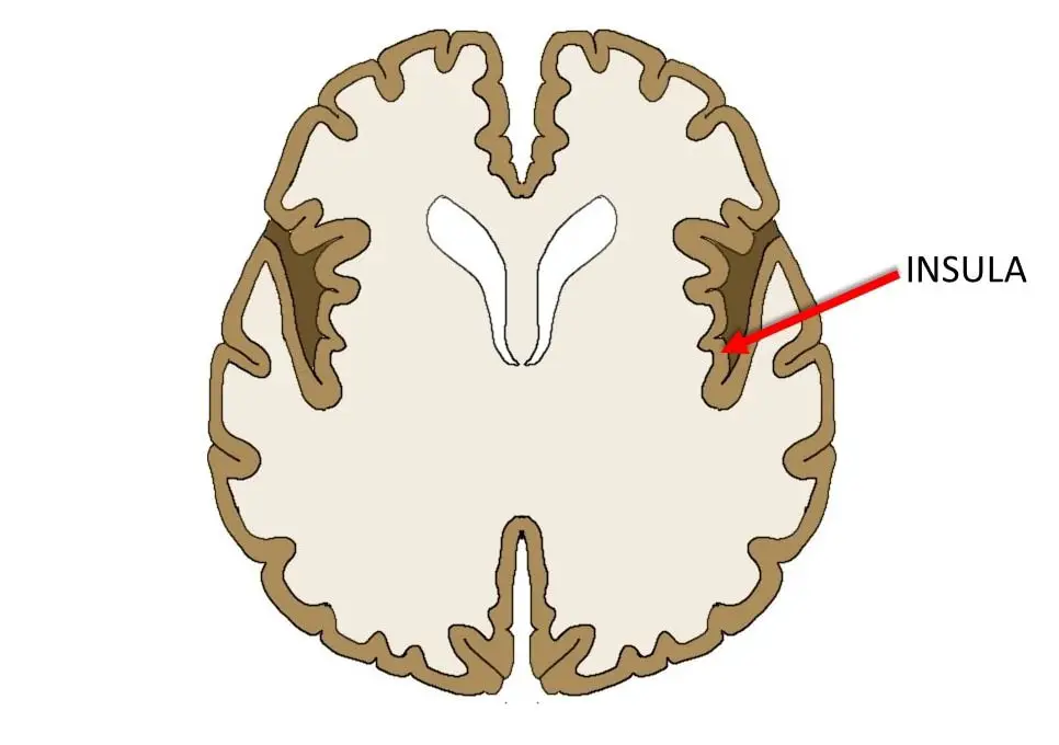 insula in horizontal brain slice.