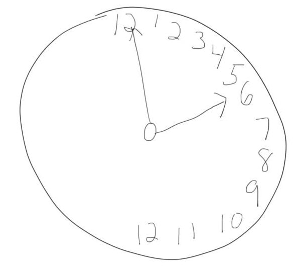an example of what a clock drawn by a patient with hemispatial neglect might look like.